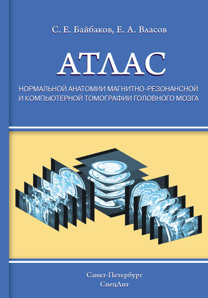 Атлас нормальной анатомии магнитно-резонансной и компьютерной томографии головного мозга - Е. А. Власов