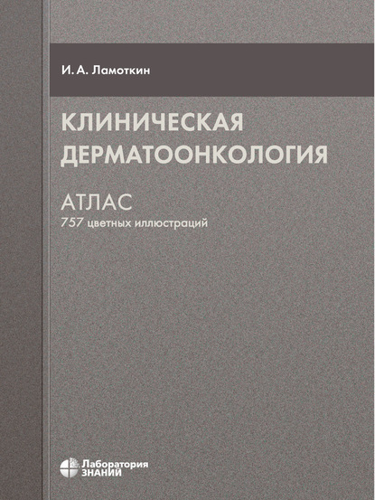 Клиническая дерматоонкология. Атлас — Игорь Ламоткин