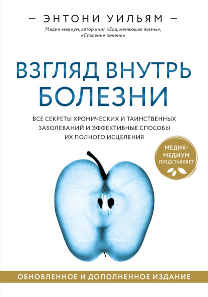 Взгляд внутрь болезни. Все секреты хронических и таинственных заболеваний и эффективные способы их полного исцеления — Энтони Уильям