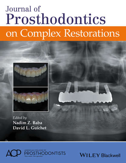 Journal of Prosthodontics on Complex Restorations - Группа авторов